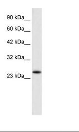 NEDF / VPS24 Antibody - HepG2 Cell Lysate.  This image was taken for the unconjugated form of this product. Other forms have not been tested.