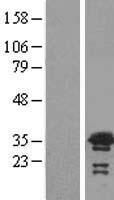 NEDF / VPS24 Protein - Western validation with an anti-DDK antibody * L: Control HEK293 lysate R: Over-expression lysate