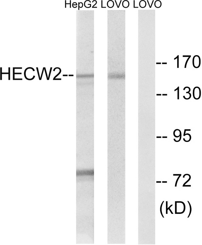 NEDL2 / HECW2 Antibody - Western blot analysis of lysates from LOVO and HepG2 cells, using HECW2 Antibody. The lane on the right is blocked with the synthesized peptide.