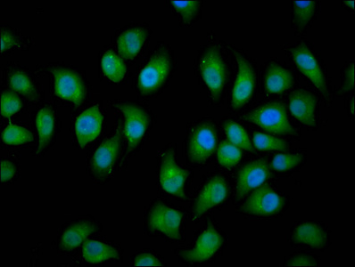 NEDL2 / HECW2 Antibody - Immunofluorescence staining of A549 cells diluted at 1:166, counter-stained with DAPI. The cells were fixed in 4% formaldehyde, permeabilized using 0.2% Triton X-100 and blocked in 10% normal Goat Serum. The cells were then incubated with the antibody overnight at 4°C.The Secondary antibody was Alexa Fluor 488-congugated AffiniPure Goat Anti-Rabbit IgG (H+L).