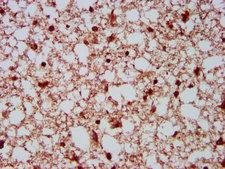 NEDL2 / HECW2 Antibody - Immunohistochemistry Dilution at 1:500 and staining in paraffin-embedded human brain tissue performed on a Leica BondTM system. After dewaxing and hydration, antigen retrieval was mediated by high pressure in a citrate buffer (pH 6.0). Section was blocked with 10% normal Goat serum 30min at RT. Then primary antibody (1% BSA) was incubated at 4°C overnight. The primary is detected by a biotinylated Secondary antibody and visualized using an HRP conjugated SP system.