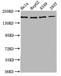NEDL2 / HECW2 Antibody - Western Blot Positive WB detected in: Hela whole cell lysate, HepG2 whole cell lysate, A549 whole cell lysate, 293T whole cell lysate All Lanes: HECW2 antibody at 3.5µg/ml Secondary Goat polyclonal to rabbit IgG at 1/50000 dilution Predicted band size: 176, 136 KDa Observed band size: 176 KDa