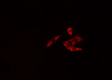 NEDL2 / HECW2 Antibody - Staining LOVO cells by IF/ICC. The samples were fixed with PFA and permeabilized in 0.1% Triton X-100, then blocked in 10% serum for 45 min at 25°C. The primary antibody was diluted at 1:200 and incubated with the sample for 1 hour at 37°C. An Alexa Fluor 594 conjugated goat anti-rabbit IgG (H+L) antibody, diluted at 1/600, was used as secondary antibody.