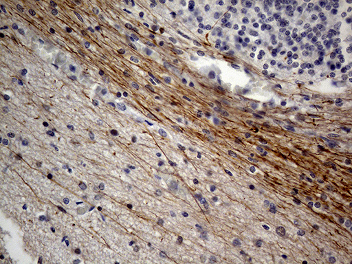 NEFH / NF-H Antibody - Immunohistochemical staining of paraffin-embedded Human embryonic cerebellum within the normal limits using anti-NEFH mouse monoclonal antibody. (Heat-induced epitope retrieval by 1mM EDTA in 10mM Tris buffer. (pH8.5) at 120°C for 3 min. (1:2000)