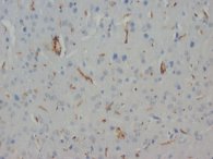 NEFH / NF-H Antibody -  This image was taken for the unconjugated form of this product. Other forms have not been tested.