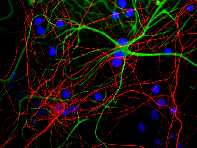 NEFH / NF-H Antibody - Mixed neuron/glial cultures stained with NEFH / NF-H antibody (red) and rabbit GFAP antibody RPCA-GFAP (green). Axonal profiles are stained in red, while astrocytic cells are revealed in green. Nuclei are revealed with a fluorescent DNA stain (blue).
