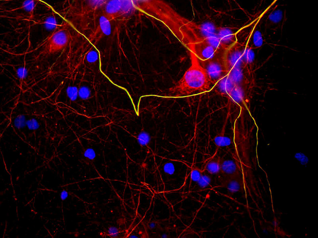 NEFH / NF-H Antibody - Mixed neuron/glial cultures stained with NEFH / NF-H antibody (green) and also stained with rabbit polyclonal antibody to neurofilament NF-L RPCA-NF-L (red). The NF-L antibody stains neurofilaments in both axons and dendrites, and so can reveal neuronal cell bodies, while NEFH / NF-H antibody binds to only heavily phosphorylated forms of NF-H which are localized to mature axonal neurofilaments. In this image a few axons course from left to right and top to bottom- since they contain both NF-L and phosphorylated NF-H they appear golden in color. Blue shows the distribution of DNA.