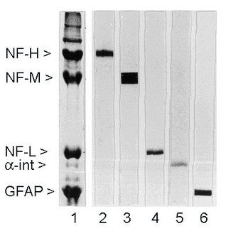 NEFH / NF-H Antibody - Rat spinal cord homogenate showing the major intermediate filament proteins of the nervous system (lane 1). The remaining lanes show blots of this material stained with various antibodies including NEFH / NF-H antibody (lane 2).