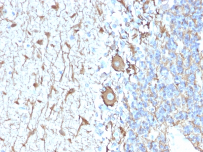NEFH / NF-H Antibody - Formalin-fixed, paraffin-embedded human Cerebellum stained with Neurofilament Rabbit Recombinant Monoclonal Antibody (NEFL.H/2324R).