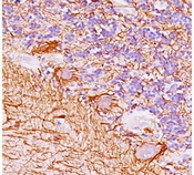 NEFH / NF-H Antibody - Neurofilament antibody NF421 immunohistochemistry cerebellum.  This image was taken for the unmodified form of this product. Other forms have not been tested.