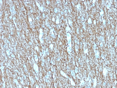 NEFH / NF-H Antibody - Formalin-fixed, paraffin-embedded human Brain stained with Neurofilament Mouse Recombinant Monoclonal Antibody (rNF421).