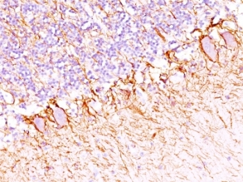 NEFH / NF-H Antibody - Formalin-fixed, paraffin-embedded human cerebellum stained with anti-NF-H antibody (SPM203).  This image was taken for the unmodified form of this product. Other forms have not been tested.