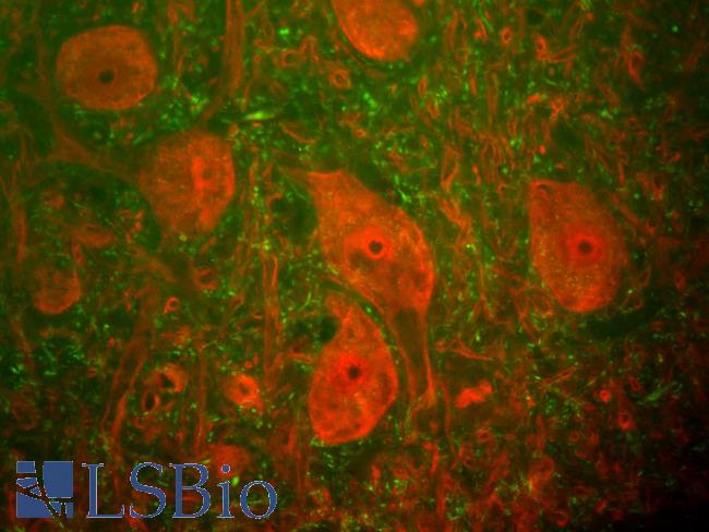 NEFH / NF-H Antibody - Shows a section of rat spinal cord stained with NEFH / NF-H antibody (green) and monoclonal antibody to ubiquitin C-terminal hydrolase 1 (UCHL1) clone MCA-BH7 (red). The neurofilament NF-H antibody binds primarily to phosphorylated axonal forms of NF-H, and so stains axons coursing between the large UCHL1 positive neurons. These large cells are motorneurons and UCHL1 protein is a major component of the perikarya and dendrites of these cells.