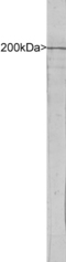 NEFH / NF-H Antibody - Blot of rat spinal cord extract blotted with NEFH / NF-H antibody. A major band running at 200kDa is NF-H, the major neurofilament subunit protein. A minor band at about 160kDa is the non-phosphorylated dendritic and perilaryal form of this protein.