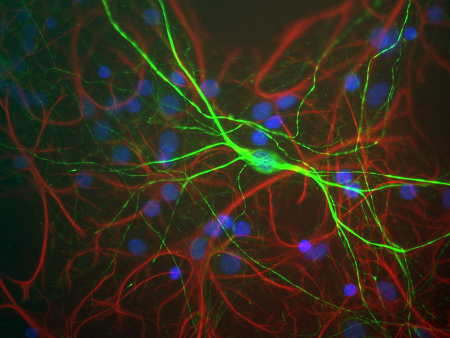 NEFH / NF-H Antibody - Shows mixed neuron/glial rat brain cultures stained with NEFH / NF-H antibody (green) and chicken polyclonal antibody to Glial Fibrillary Acidic Protein (GFAP) (red). The neurofilament NF-H antibody binds to phosphorylated axonal forms of NF-H and non-phosphorylated dendritic and perikaryal forms.