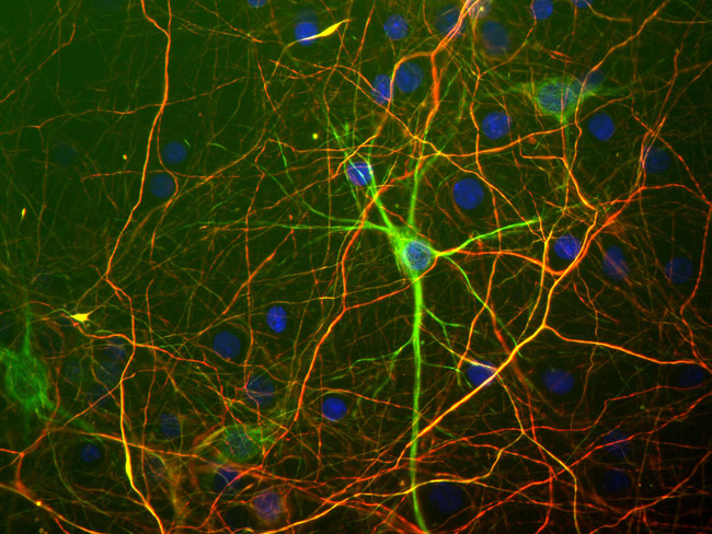 NEFH / NF-H Antibody - Rat mixed neuron/glial cultures stained with mouse monoclonal antibody to neurofilament subunit NF-L MCA-7D1 (green) and NEFH / NF-H antibody, rabbit antibody to neurofilament NF-H. This antibody binds primarily to the phosphorylated axonal forms of NF-H, in contrast to the NF-L antibody which stains both axonal and dendritic/perikaryal neurofilaments. The NF-L antibody therefore reveals a prominent cell body in green, while the surrounding axonal profiles are orange, since the are bound by both NF-L and the chicken NF-H antibody. Blue is a DNA stain.