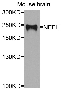 NEFH / NF-H Antibody - Western blot analysis of extracts of mouse brain cells.
