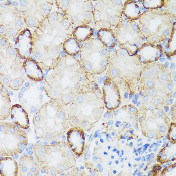 NEFH / NF-H Antibody - Immunohistochemistry of paraffin-embedded mouse kidney tissue.