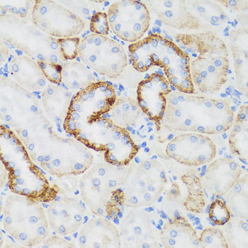 NEFH / NF-H Antibody - Immunohistochemistry of paraffin-embedded rat kidney tissue.