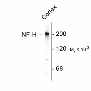 NEFH / NF-H Antibody - Western blot of rat cortex lysate showing specific immunolabeling of the ~200k NF-H protein.