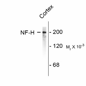 NEFH / NF-H Antibody - Western blot of rat cortex lysate showing specific immunolabeling of the ~200k NF-H protein.