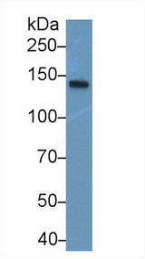 NEFM / NF-M Antibody - Western Blot; Sample: Mouse Spinal cord lysate; Primary Ab: 1µg/ml Rabbit Anti-Human NEF3 Antibody Second Ab: 0.2µg/mL HRP-Linked Caprine Anti-Rabbit IgG Polyclonal Antibody