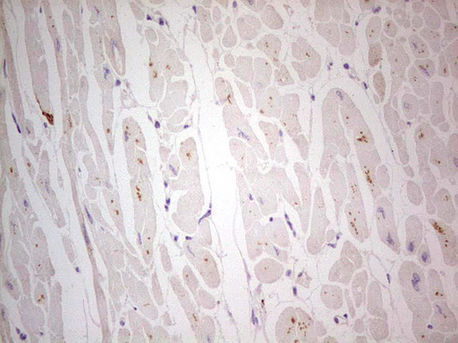 NEFM / NF-M Antibody - Immunohistochemical staining of paraffin-embedded Human adult heart tissue using anti-NEFM mouse monoclonal antibody. (Heat-induced epitope retrieval by 1 mM EDTA in 10mM Tris, pH8.5, 120C for 3min,