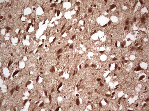 NEFM / NF-M Antibody - Immunohistochemical staining of paraffin-embedded Human adult brain tissue using anti-NEFM mouse monoclonal antibody. (Heat-induced epitope retrieval by 1 mM EDTA in 10mM Tris, pH8.5, 120C for 3min,
