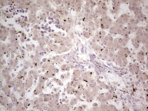 NEFM / NF-M Antibody - Immunohistochemical staining of paraffin-embedded Human embryonic liver tissue using anti-NEFM mouse monoclonal antibody. (Heat-induced epitope retrieval by 1 mM EDTA in 10mM Tris, pH8.5, 120C for 3min,