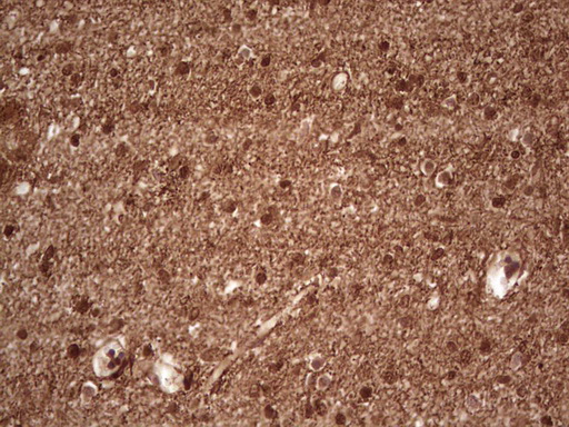 NEFM / NF-M Antibody - Immunohistochemical staining of paraffin-embedded Human embryonic cerebellum using anti-NEFM mouse monoclonal antibody. (Heat-induced epitope retrieval by 1 mM EDTA in 10mM Tris, pH8.5, 120C for 3min,