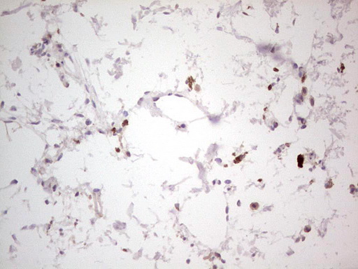 NEFM / NF-M Antibody - IHC of paraffin-embedded Human skin tissue using anti-NEFM mouse monoclonal antibody. (Heat-induced epitope retrieval by 1 mM EDTA in 10mM Tris, pH8.5, 120°C for 3min).