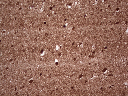 NEFM / NF-M Antibody - IHC of paraffin-embedded Human embryonic brain cortex tissue using anti-NEFM mouse monoclonal antibody. (Heat-induced epitope retrieval by 1 mM EDTA in 10mM Tris, pH8.5, 120°C for 3min).