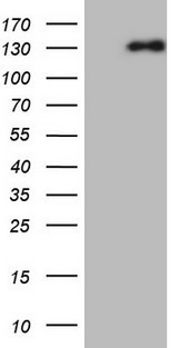 NEFM / NF-M Antibody - HEK293T cells were transfected with the pCMV6-ENTRY control. (Left lane) or pCMV6-ENTRY NEFM. (Right lane) cDNA for 48 hrs and lysed. Equivalent amounts of cell lysates. (5 ug per lane) were separated by SDS-PAGE and immunoblotted with anti-NEFM.