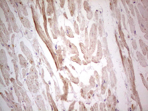 NEFM / NF-M Antibody - Immunohistochemical staining of paraffin-embedded Human adult heart tissue using anti-NEFM mouse monoclonal antibody. (Heat-induced epitope retrieval by 1 mM EDTA in 10mM Tris, pH8.5, 120C for 3min,