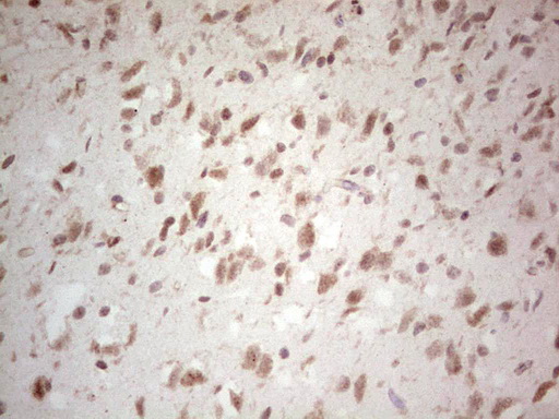NEFM / NF-M Antibody - Immunohistochemical staining of paraffin-embedded Human adult brain tissue using anti-NEFM mouse monoclonal antibody. (Heat-induced epitope retrieval by 1 mM EDTA in 10mM Tris, pH8.5, 120C for 3min,