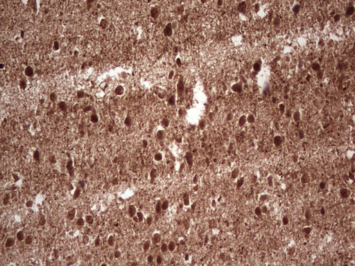 NEFM / NF-M Antibody - Immunohistochemical staining of paraffin-embedded Human embryonic brain cortex tissue using anti-NEFM mouse monoclonal antibody. (Heat-induced epitope retrieval by 1 mM EDTA in 10mM Tris, pH8.5, 120C for 3min,