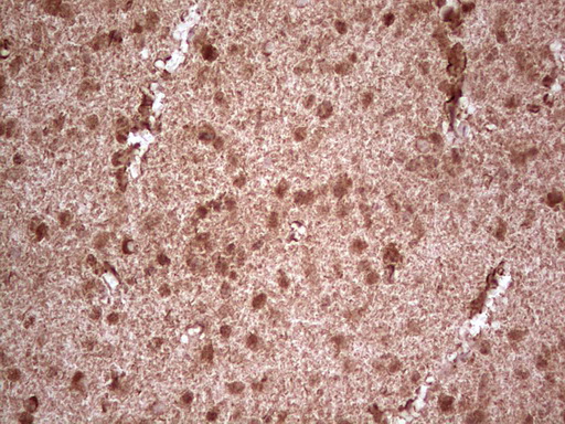 NEFM / NF-M Antibody - Immunohistochemical staining of paraffin-embedded Human embryonic cerebellum using anti-NEFM mouse monoclonal antibody. (Heat-induced epitope retrieval by 1 mM EDTA in 10mM Tris, pH8.5, 120C for 3min,