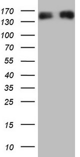 NEFM / NF-M Antibody - HEK293T cells were transfected with the pCMV6-ENTRY control (Left lane) or pCMV6-ENTRY NEFM (Right lane) cDNA for 48 hrs and lysed. Equivalent amounts of cell lysates (5 ug per lane) were separated by SDS-PAGE and immunoblotted with anti-NEFM.
