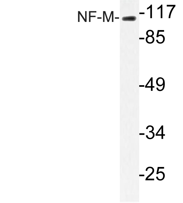 NEFM / NF-M Antibody - Western blot analysis of lysate from MCF-7cells, using NF-M antibody.