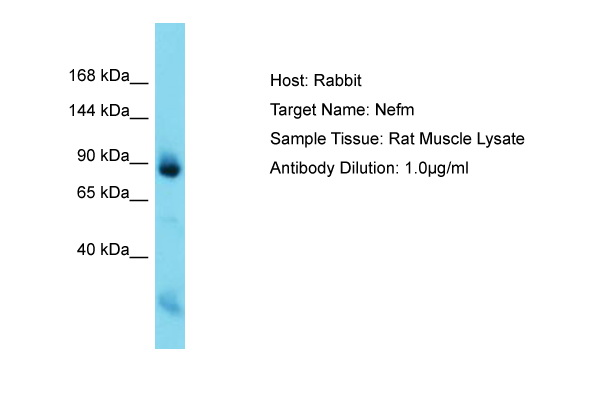 NEFM / NF-M Antibody -  This image was taken for the unconjugated form of this product. Other forms have not been tested.
