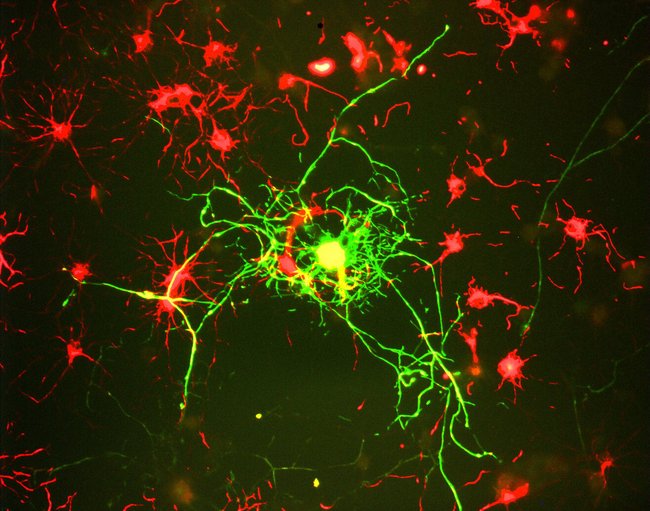 NEFM / NF-M Antibody - Culture of adult neural cells grown as described (2). Mature neurons can be identified by their morphology and because they stain strongly with antibodies to NF-L, NF-M and NF-H. The surrounding stellate red cells are stained with rabbit polyclonal Rat facial nucleus. These are apparently mitotic neuronal progenitor cells and express many other neuronal markers.