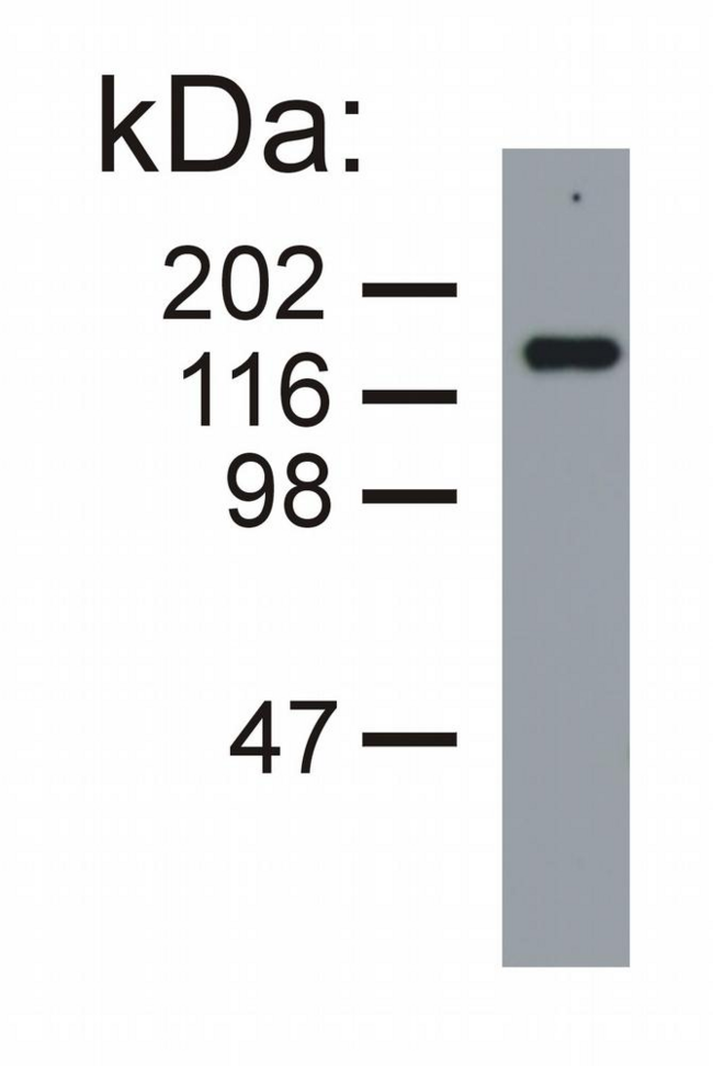 NEFM / NF-M Antibody - Western blotting analysis of neurofilament medium protein in porcine brain lysate (reducing conditions) by mouse monoclonal NF-09.