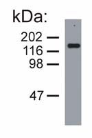 NEFM / NF-M Antibody - NEFM Antibody in Western Blot (WB)