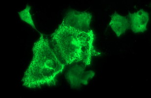 NEFM / NF-M Antibody - Anti-NEFM mouse monoclonal antibody immunofluorescent staining of COS7 cells transiently transfected by pCMV6-ENTRY NEFM.