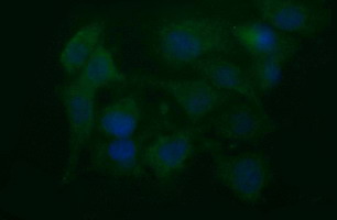 NEFM / NF-M Antibody - Immunofluorescent staining of HeLa cells using anti-NEFM mouse monoclonal antibody.