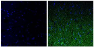 NEFM / NF-M Antibody - Immunofluorescent analysis of the neurofilament medium chain in paraffin-embedded human brain tissue (right) compared to a negative control without primary antibody (left). Tissue sections were deparaffinized with xylene, and rehydrated with ethanol. To expose target proteins, antigen retrieval was performed using 10mM sodium citrate (pH 6.0) and microwaved for 8-15 min. Following antigen retrieval, tissues were washed with water and PBS, and then blocked in 0.3% BSA for 30 min at room temperature. Tissues were then probed with a neurofilament light chain monoclonal antibody in 0.3% BSA at a dilution of 1:50 for 1 hour at 37°C. Tissues were then incubated with a Goat anti-Mouse IgG (H+L) Secondary Antibody, DyLight 488 conjugate for 1 hour at 37°C (green). Nuclei (blue) were stained with DAPI. Images were taken at 40X magnification.