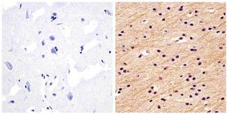 NEFM / NF-M Antibody - Immunohistochemistry analysis of the neurofilament medium chain showing staining in the filaments of paraffin-embedded human brain tissue (right) compared to a negative control without primary antibody (left). To expose target proteins, antigen retrieval was performed using 10mM sodium citrate (pH 6.0) and microwaved for 8-15 min. Following antigen retrieval, tissues were blocked in 3% H2O2-methanol for 15 min at room temperature, washed with ddH2O and PBS, and then probed with a Neurofilament medium chain monoclonal antibody diluted in 3% BSA-PBS at a dilution of 1:20 overnight at 4°C in a humidified chamber. Tissues were washed extensively in PBST and detection was performed using an HRP-conjugated secondary antibody followed by colorimetric detection using a DAB kit. Tissues were counterstained with hematoxylin and dehydrated with ethanol and xylene to prep for mounting.