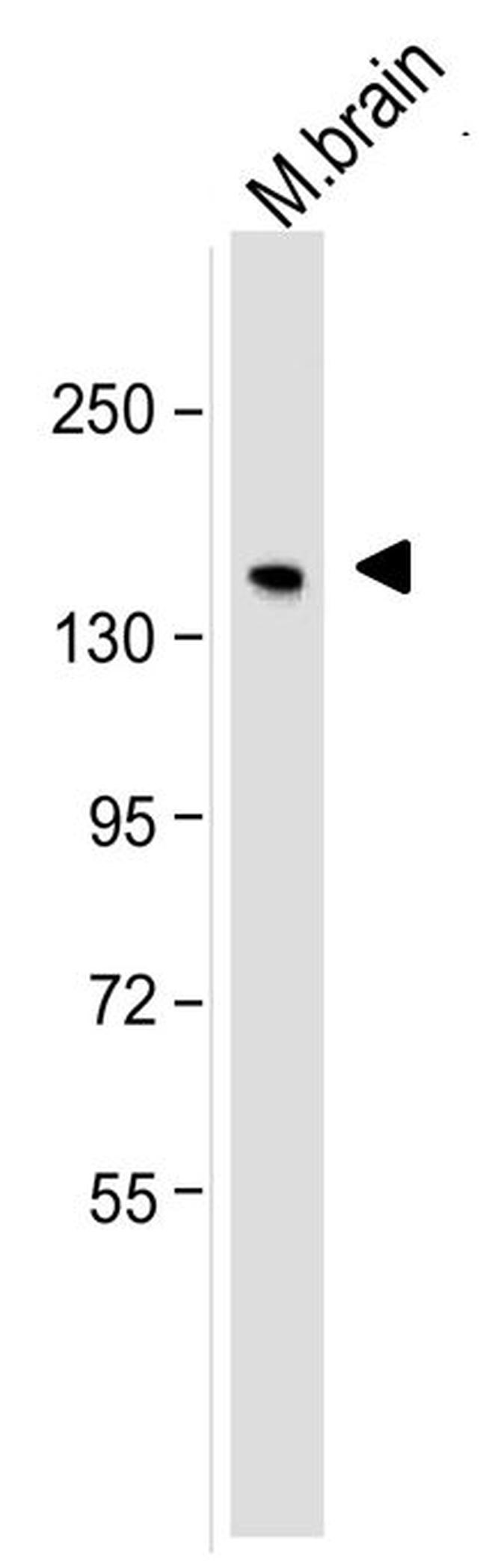 NEFM / NF-M Antibody - Western blot analysis of neurofilament, medium chain was performed by loading 25ug of mouse brain tissue lysate per well onto a polyacrylamide gel. Proteins were transferred to a PVDF membrane and blocked. NF-M was detected at ~160kD using a neurofilament, medium chain antibody at a dilution of 2 µg/mL in blocking buffer overnight at 4C, followed by a HRP-labeled secondary antibody for 1 hour at room temperature and detection with a chemiluminescent substrate.