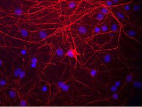 NEFM / NF-M Antibody - Immunostaining of cultured rat neurons and glia showing labeling of NF-M in red.