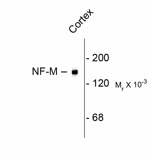 NEFM / NF-M Antibody - Western Blot of NEFM antibody. Western blot of rat cortex lysate showing specific immunolabeling of ~ 145k NEFM protein